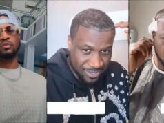 Peter Okoye undergoes hair transplant in Turkey
